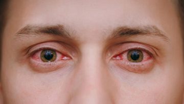Close-up-of-red-eyes-Big-spotlight-size