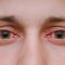 Close-up-of-red-eyes-Big-spotlight-size